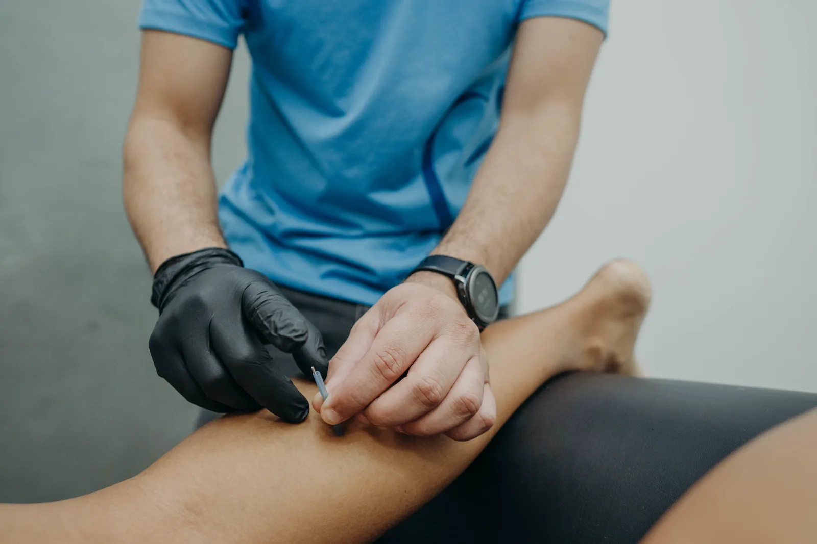 Aplicação da técnica de dry needling na Clínica FisioLeve